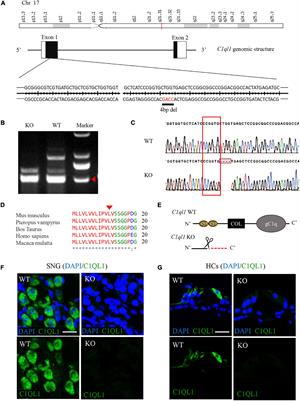 Deletion of C1ql1 Causes Hearing Loss and Abnormal Auditory Nerve Fibers in the Mouse Cochlea